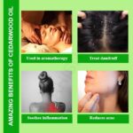 Cedarwood Oil