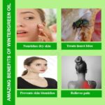 Wintergreen Oil