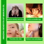 Manuka Oil