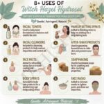 8 uses of witch hazel hydrosol
