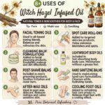 8 uses of witch hazel infused oil